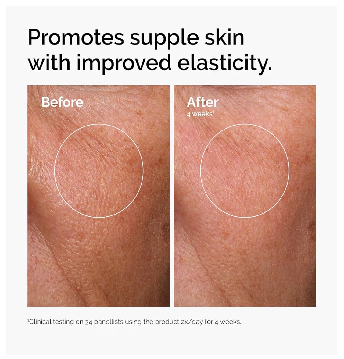 2% Hyaluronic Acid Serum with Ceramides & B5 – Deep Hydration for Plump, Dewy Skin
