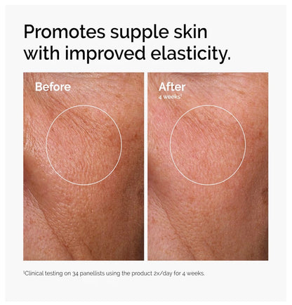 2% Hyaluronic Acid Serum with Ceramides & B5 – Deep Hydration for Plump, Dewy Skin